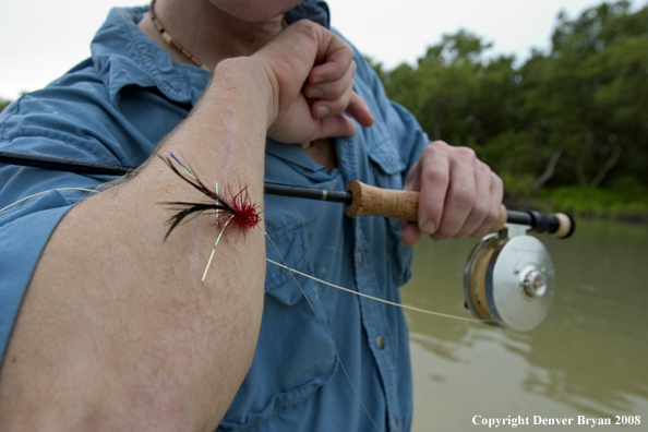 Flyfisherman w/hook on his arm